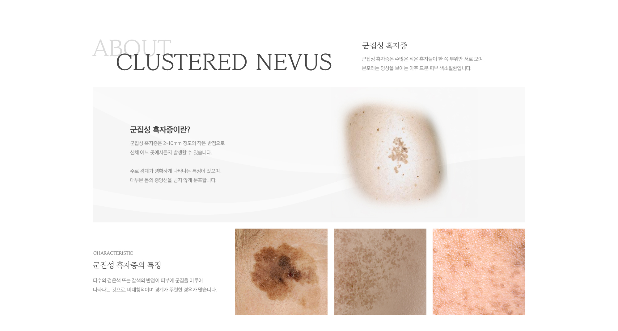 군집성 흑자증