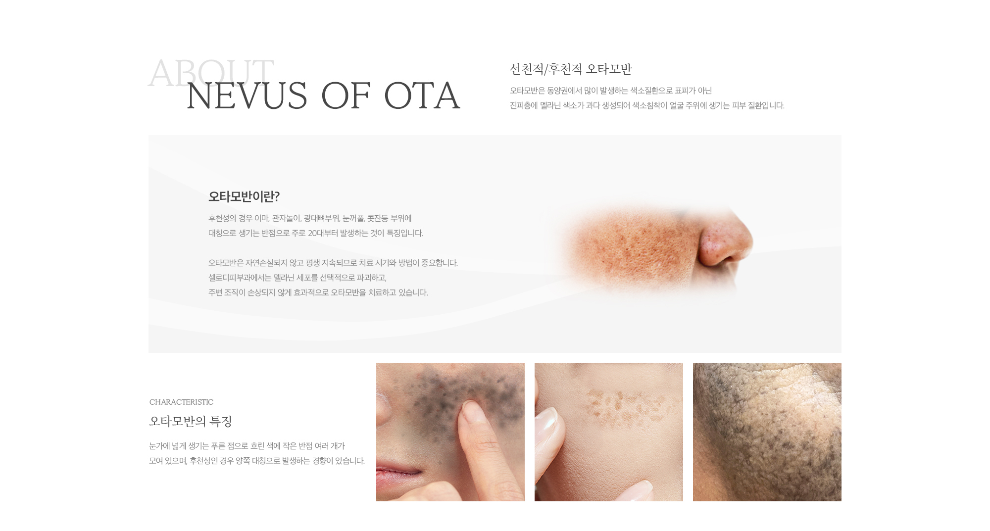 선천적/후천적적 오타모반